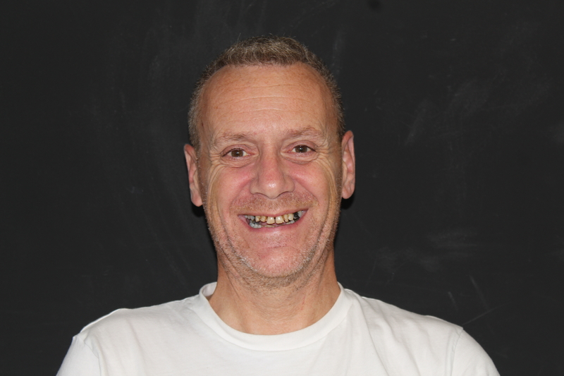 Patient 3 before dental implants